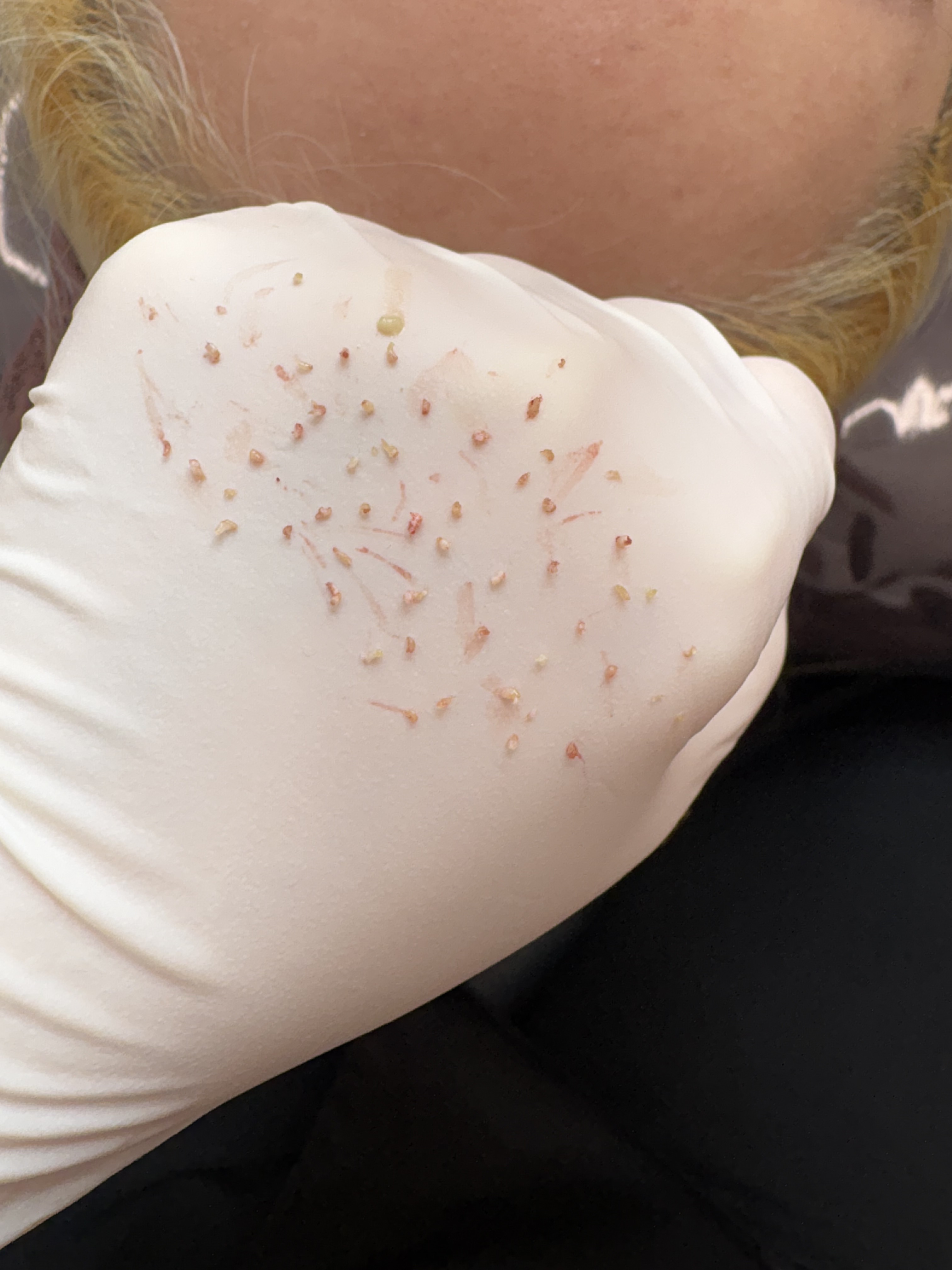 페바아크네룸 대표 이미지