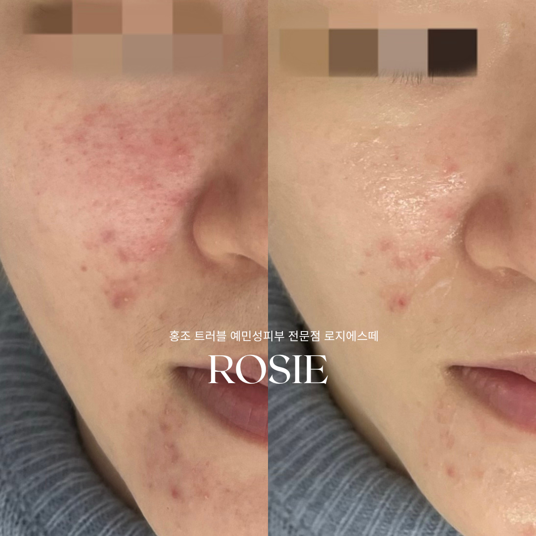 로지에스떼 대표 이미지