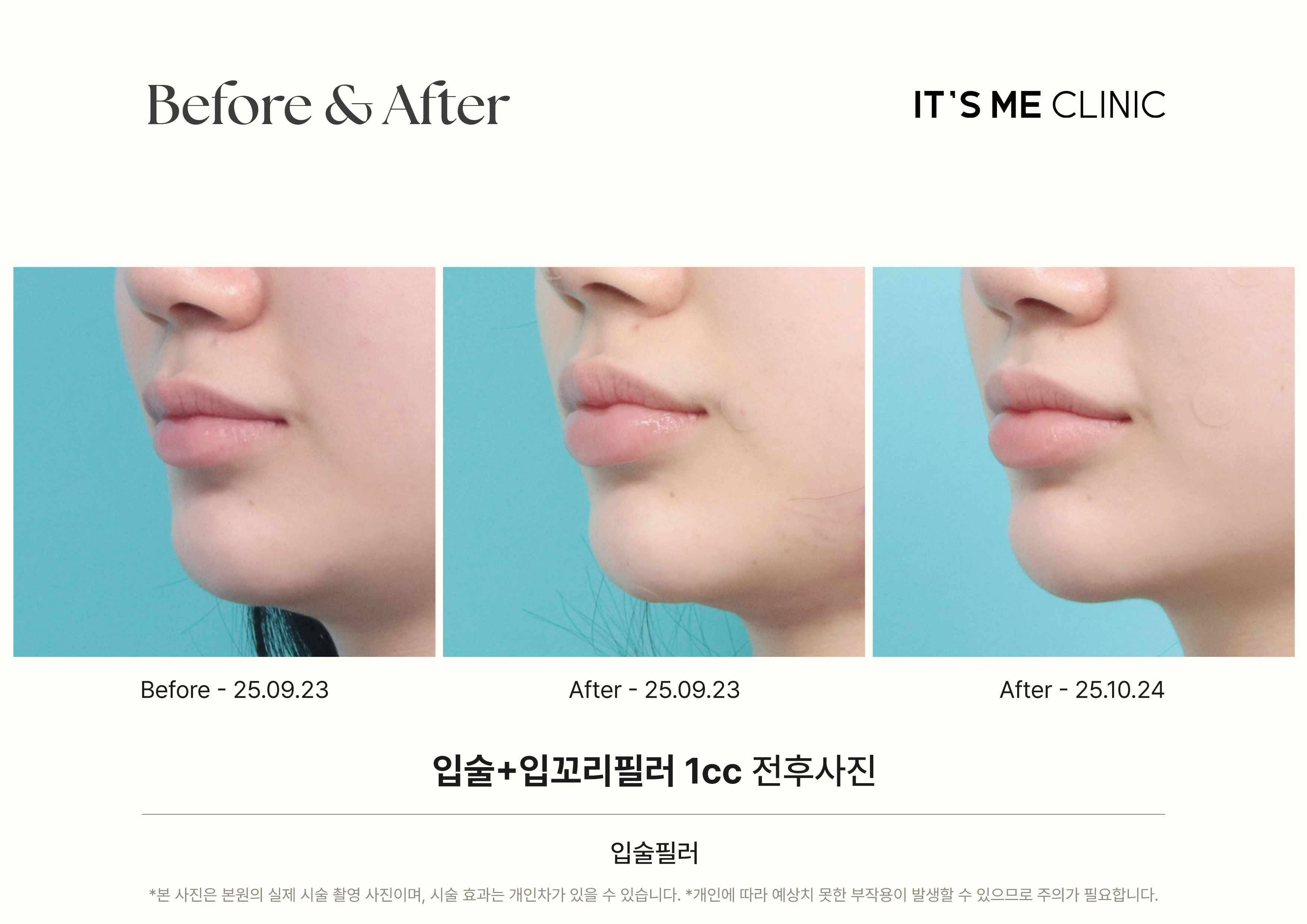 잇츠미 성형외과 대표 이미지
