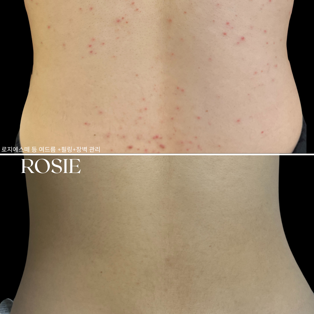 로지에스떼 대표 이미지