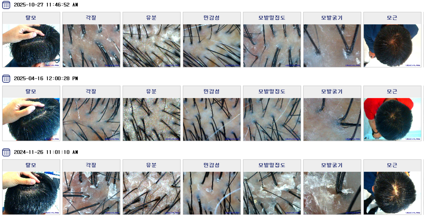 배럴스두피탈모센터 대표 이미지