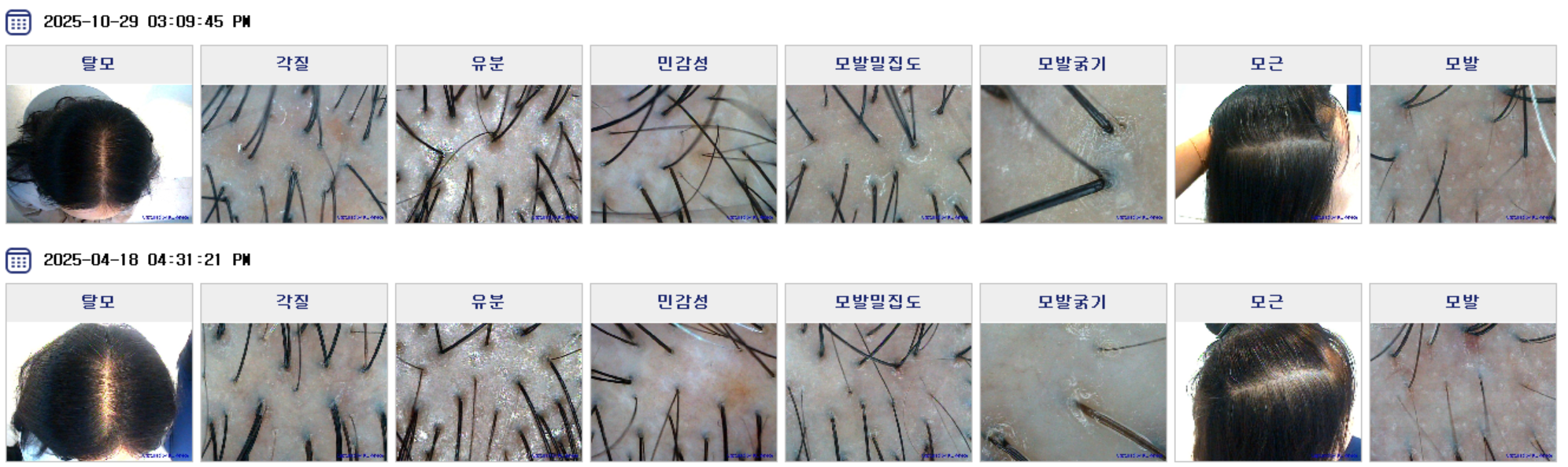 배럴스두피탈모센터 대표 이미지