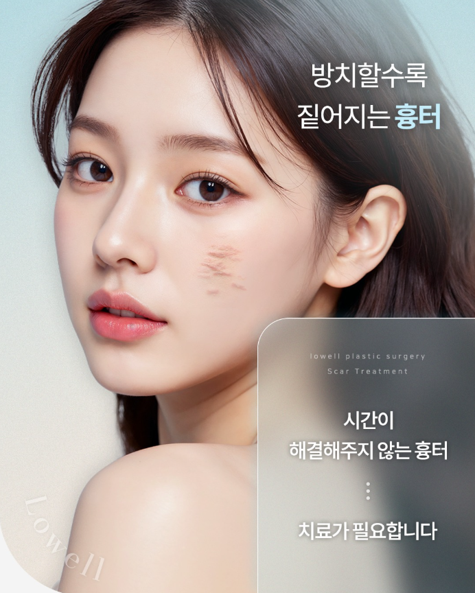 로웰성형외과 대표 이미지