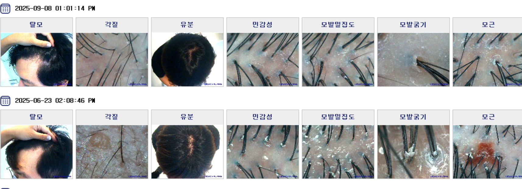 배럴스두피탈모센터 대표 이미지