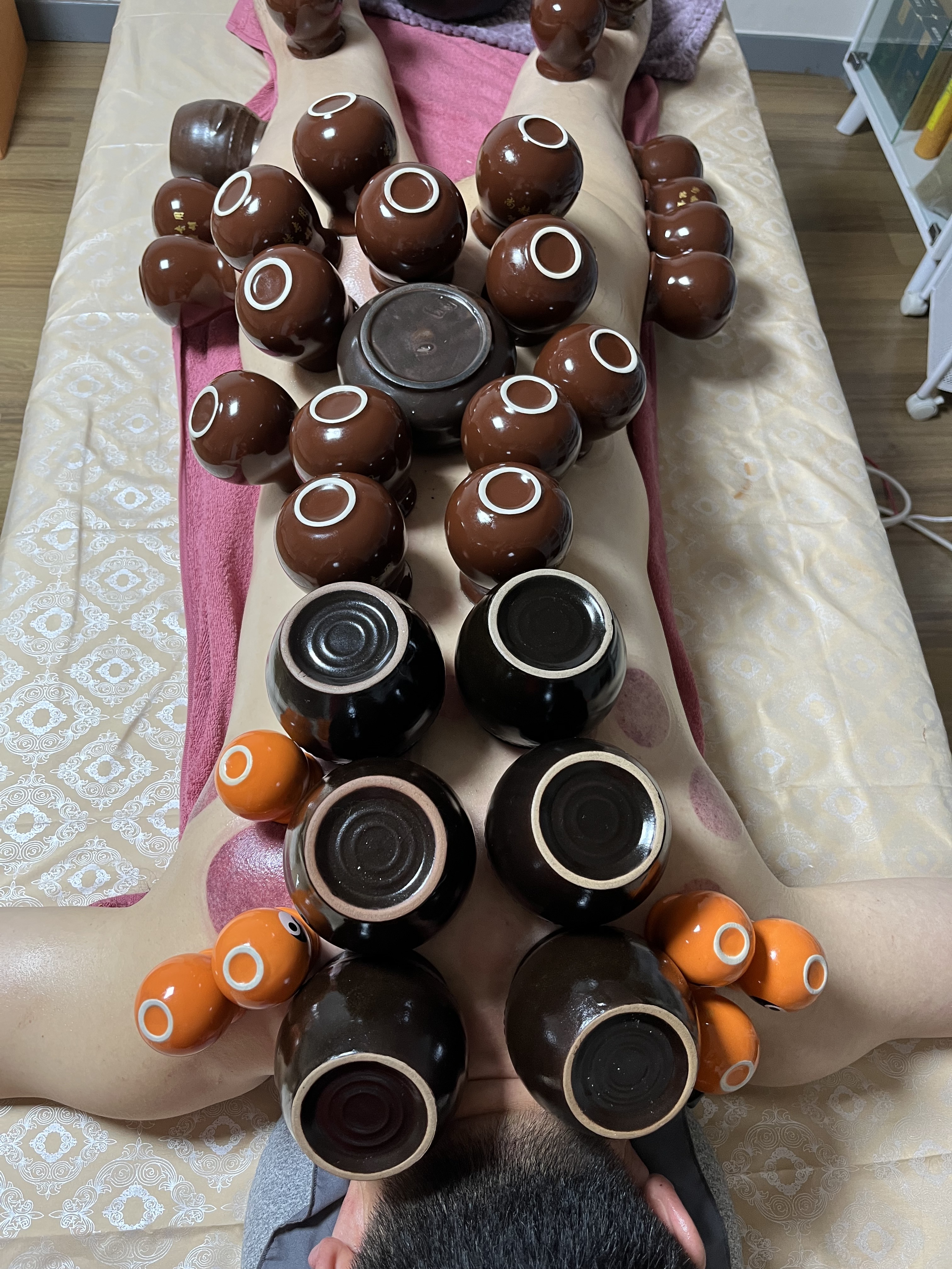 명샘약손 photo 10