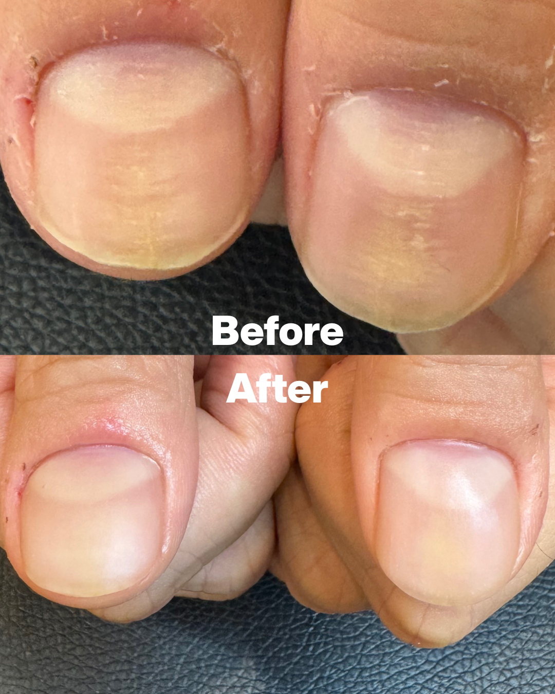 모스네일 대표 이미지