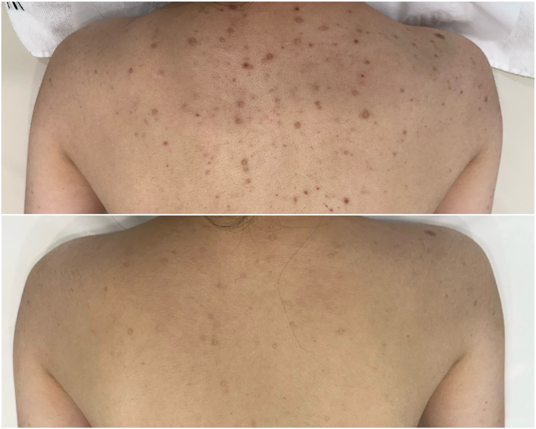 하이필스킨 대표 이미지