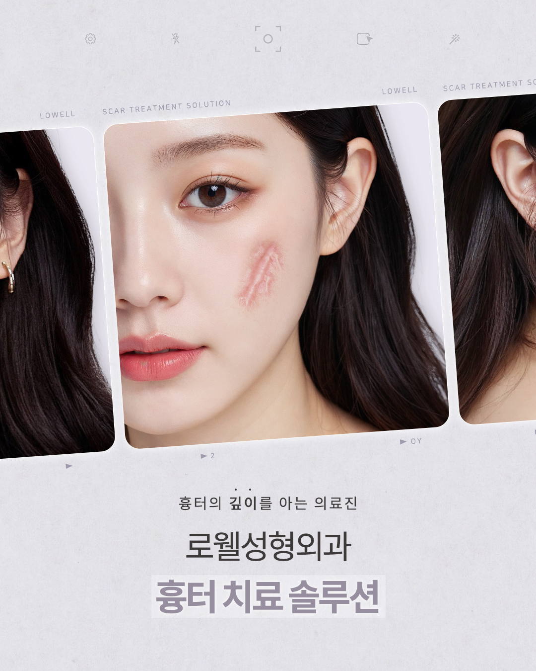 로웰성형외과 강남점 대표 이미지