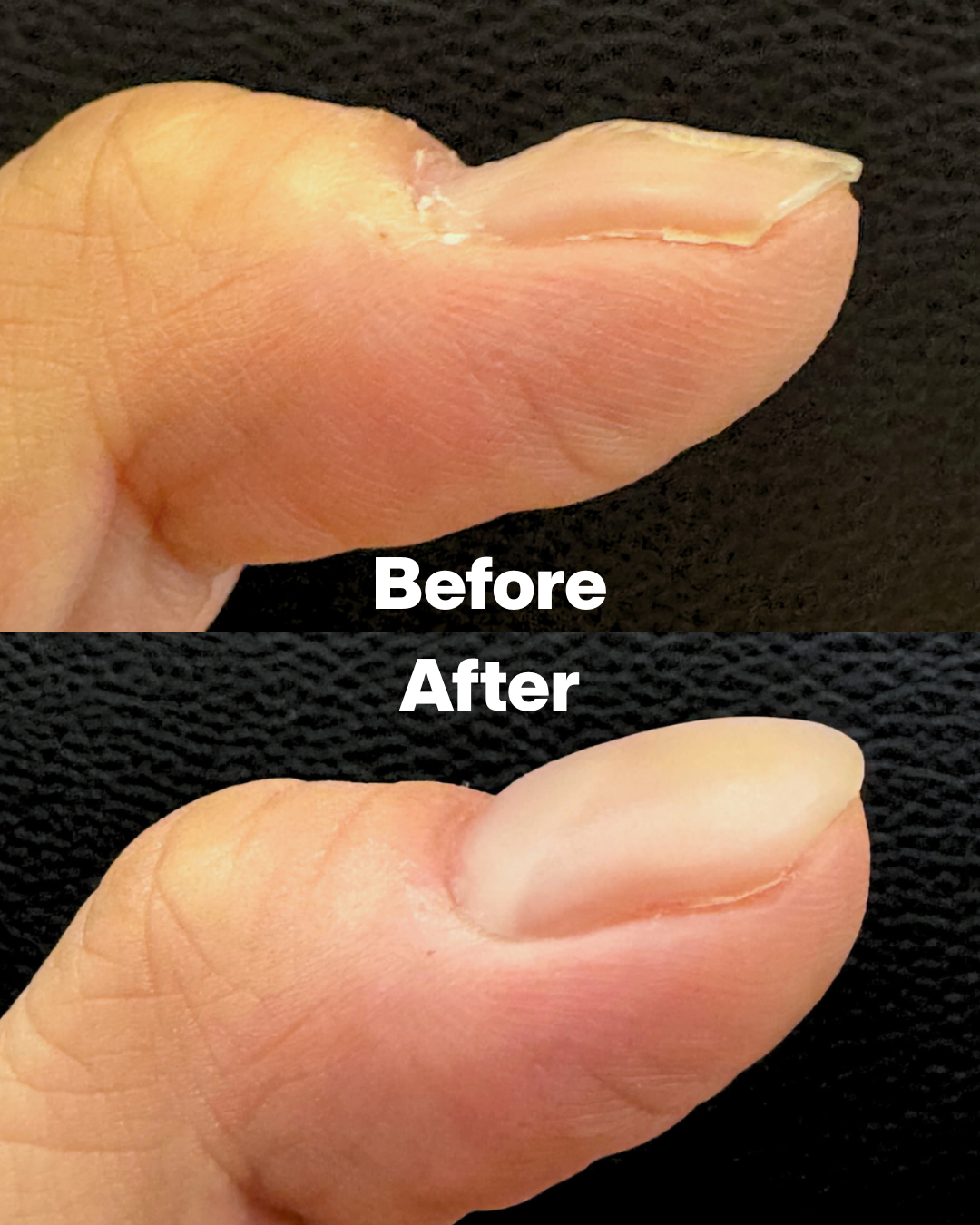 모스네일 대표 이미지