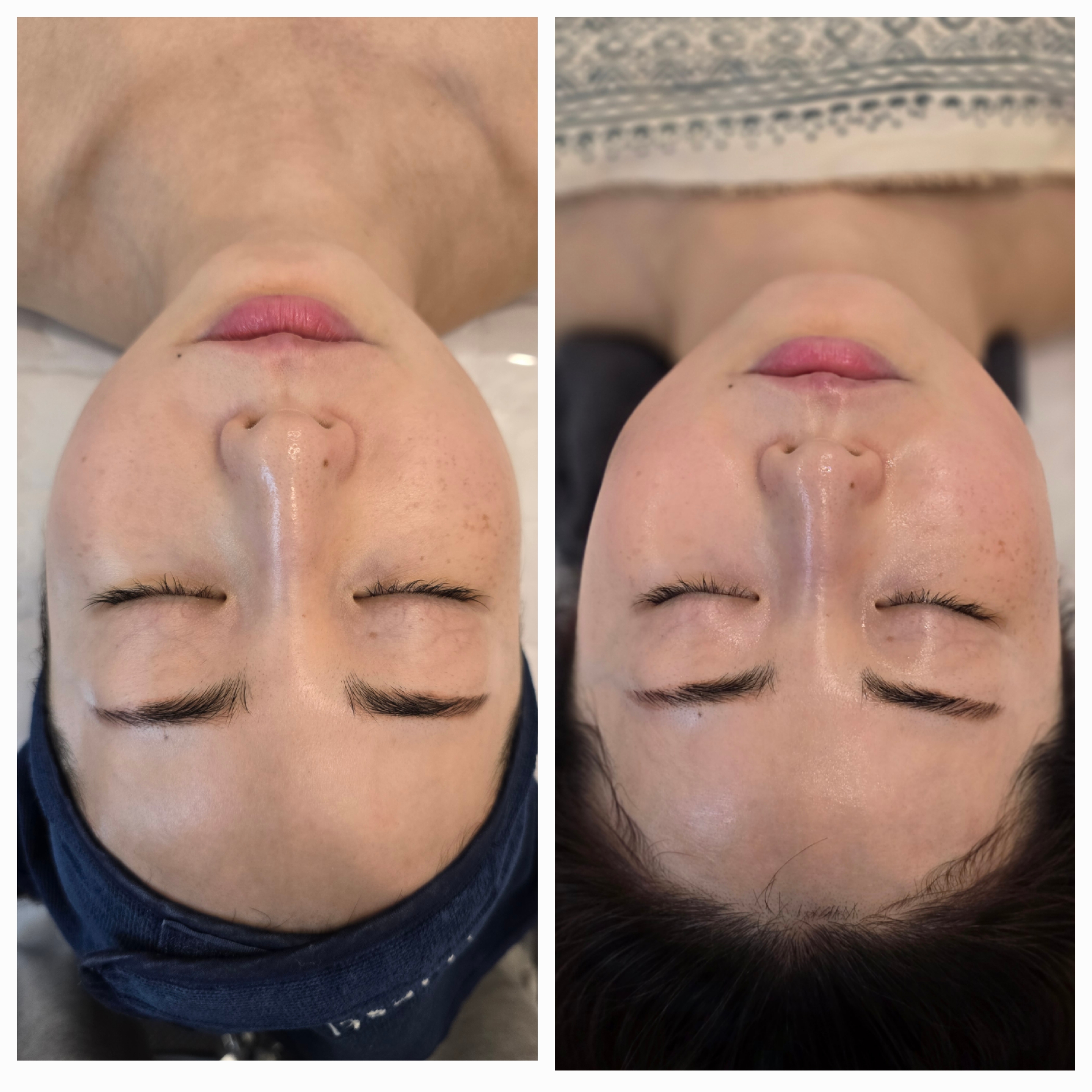 뷰티브레스 김해진영 photo 3
