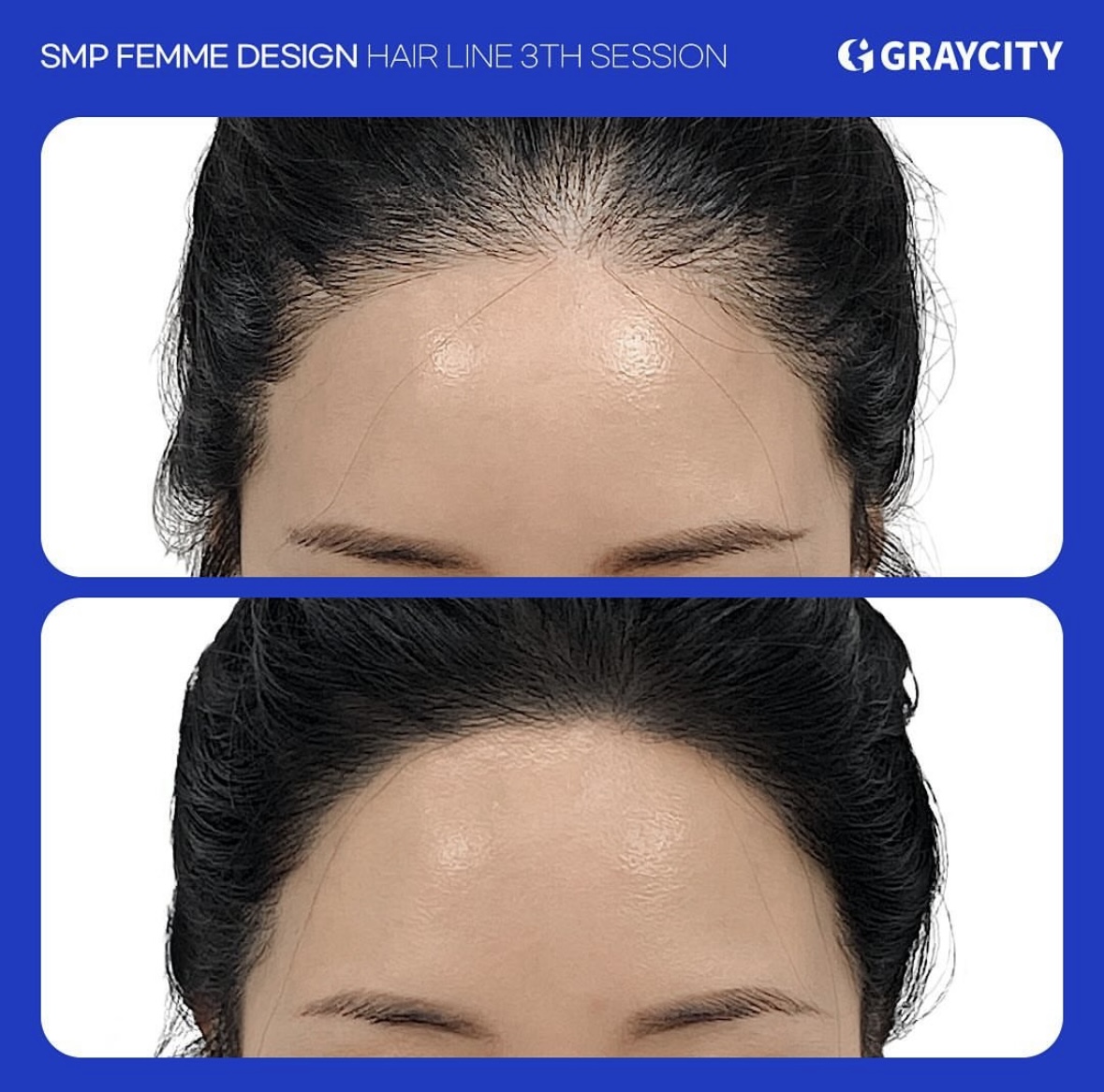 그레이시티 광주직영점 대표 이미지