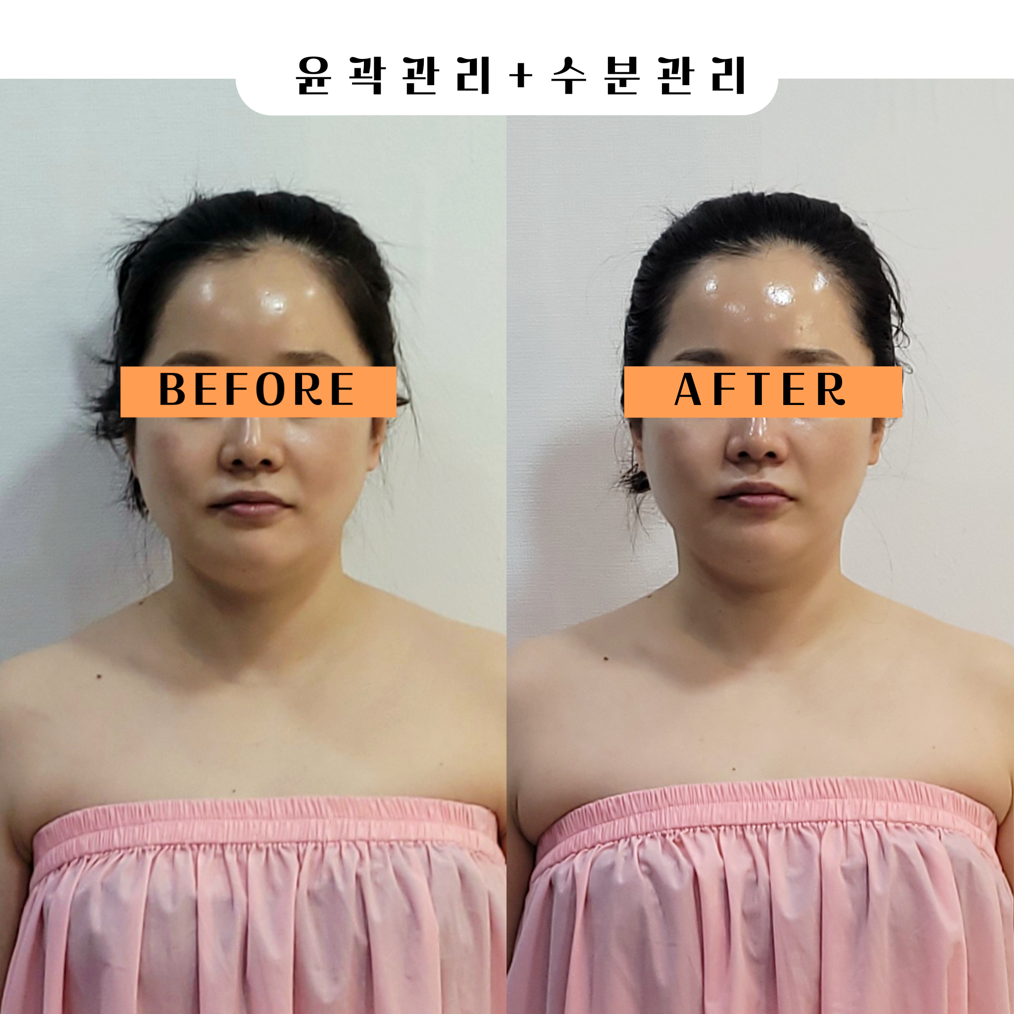 피부이야기 오류점 대표 이미지