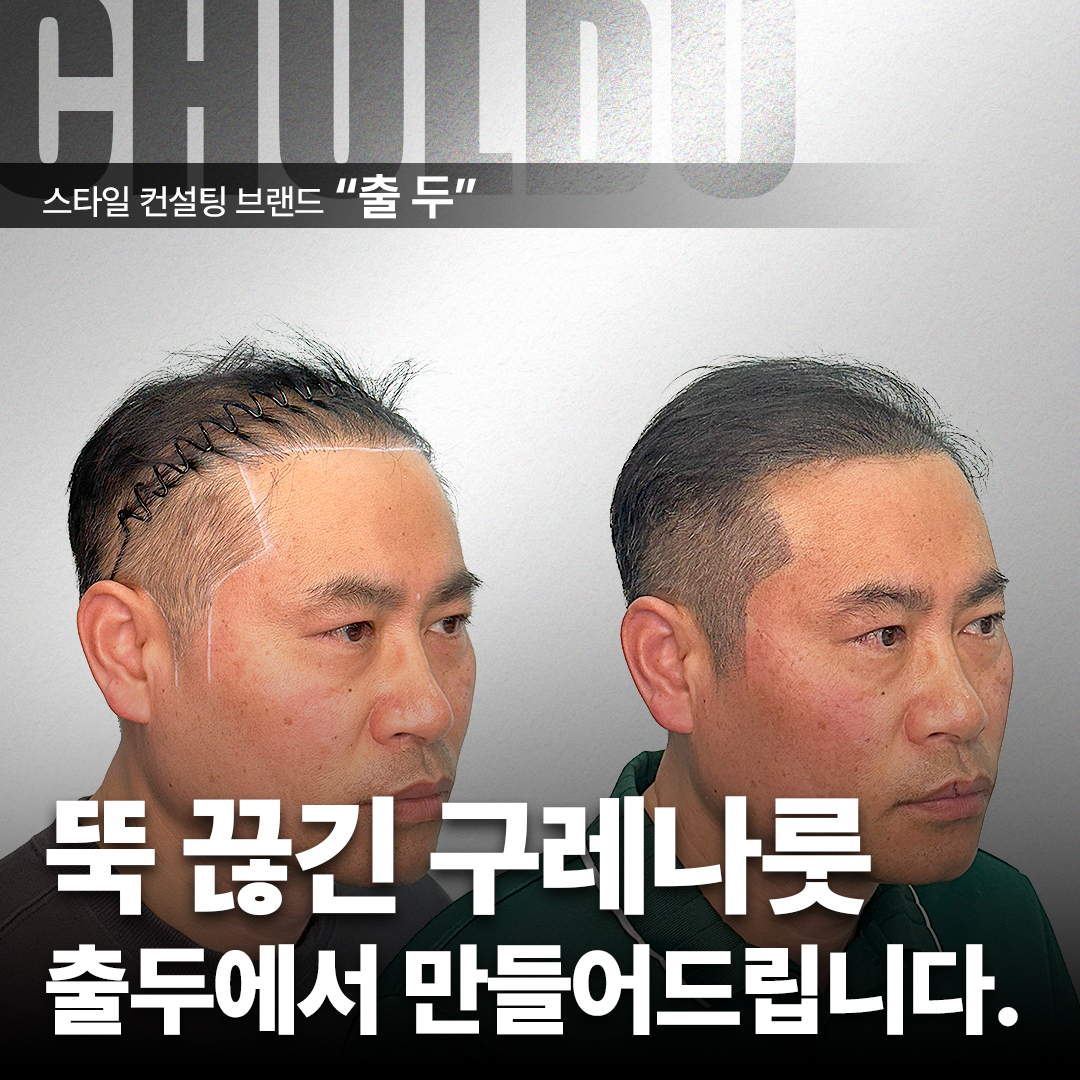 출두SMP 강남본점 대표 이미지