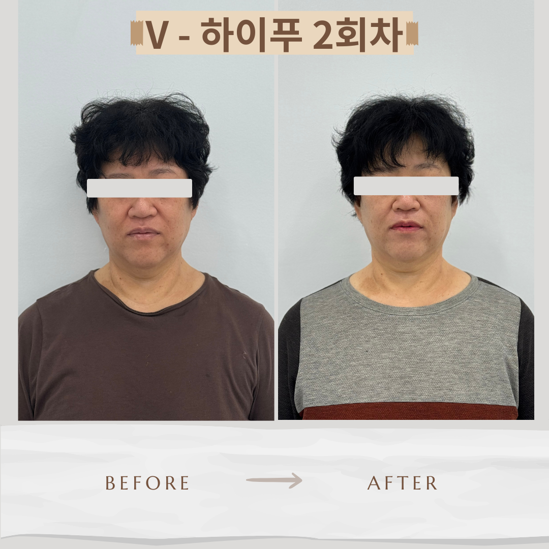 오늘도 새로운 하루 photo 6