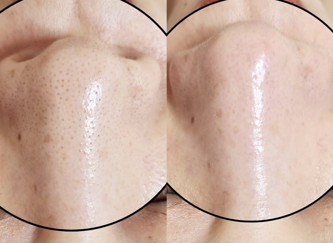 뷰티선셋 모공전문센터 부천본점 대표 이미지