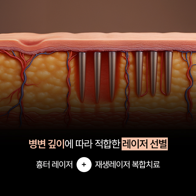 목동미소가인피부과 대표 이미지
