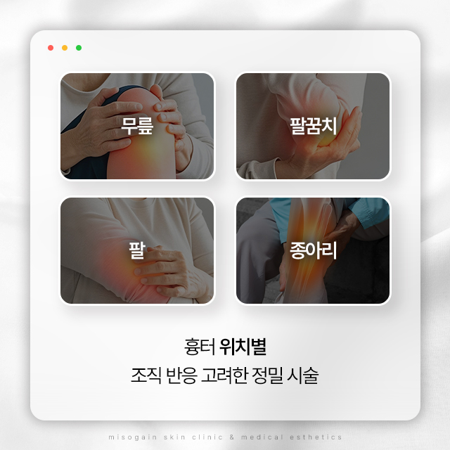 목동미소가인피부과 대표 이미지