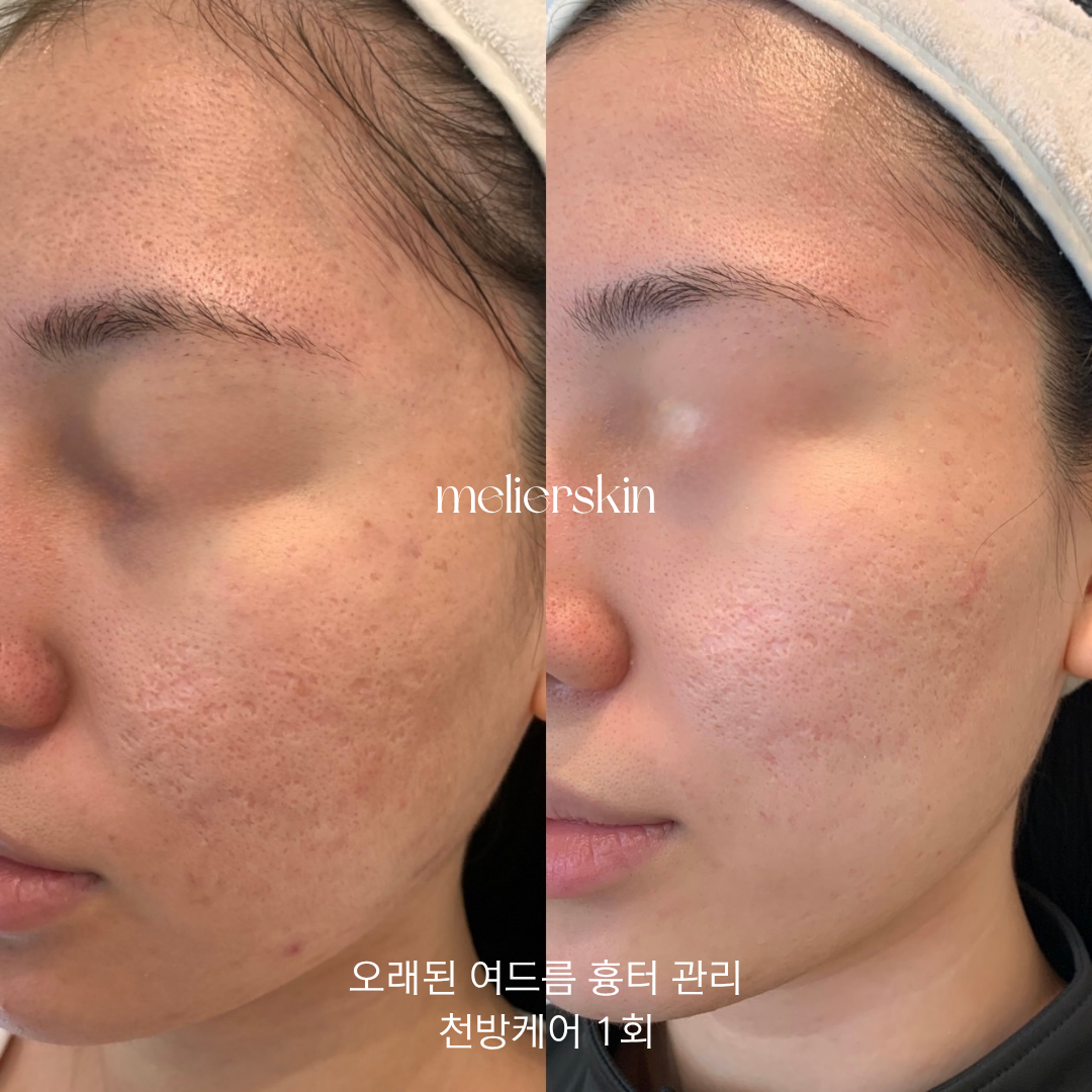 믈리에스킨 대표 이미지