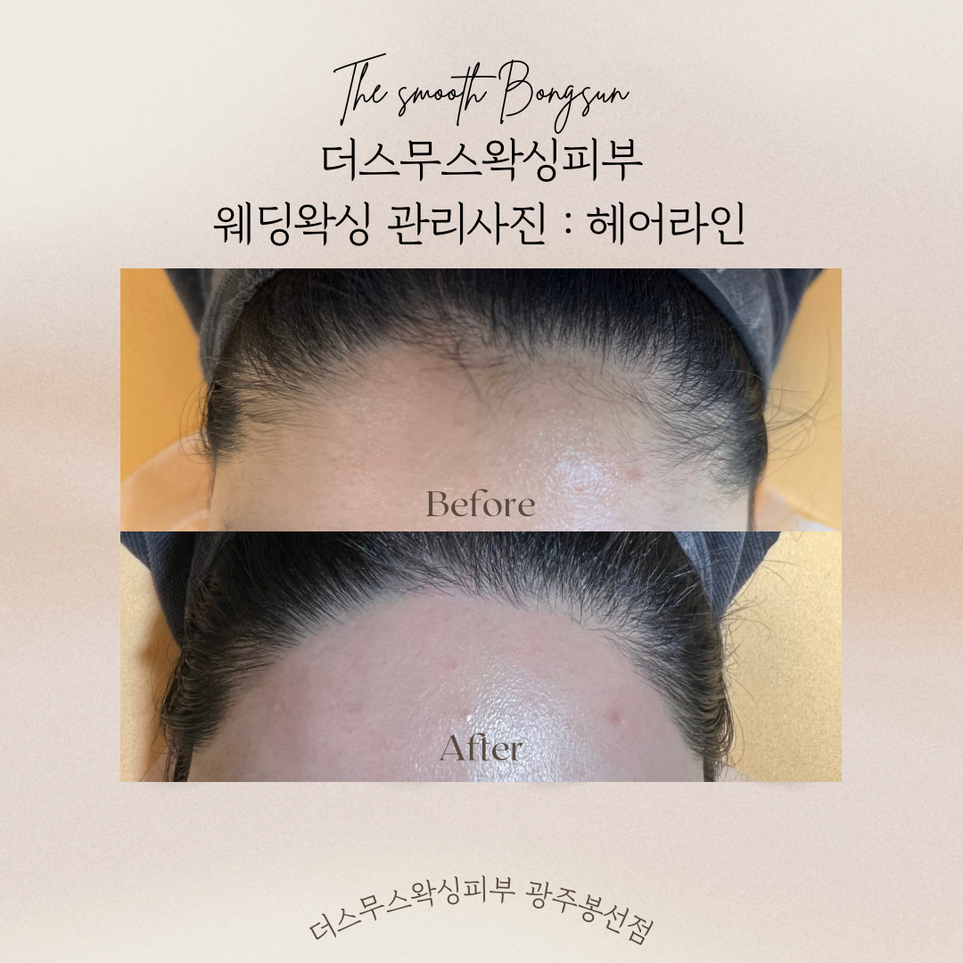더스무스왁싱피부 대표 이미지