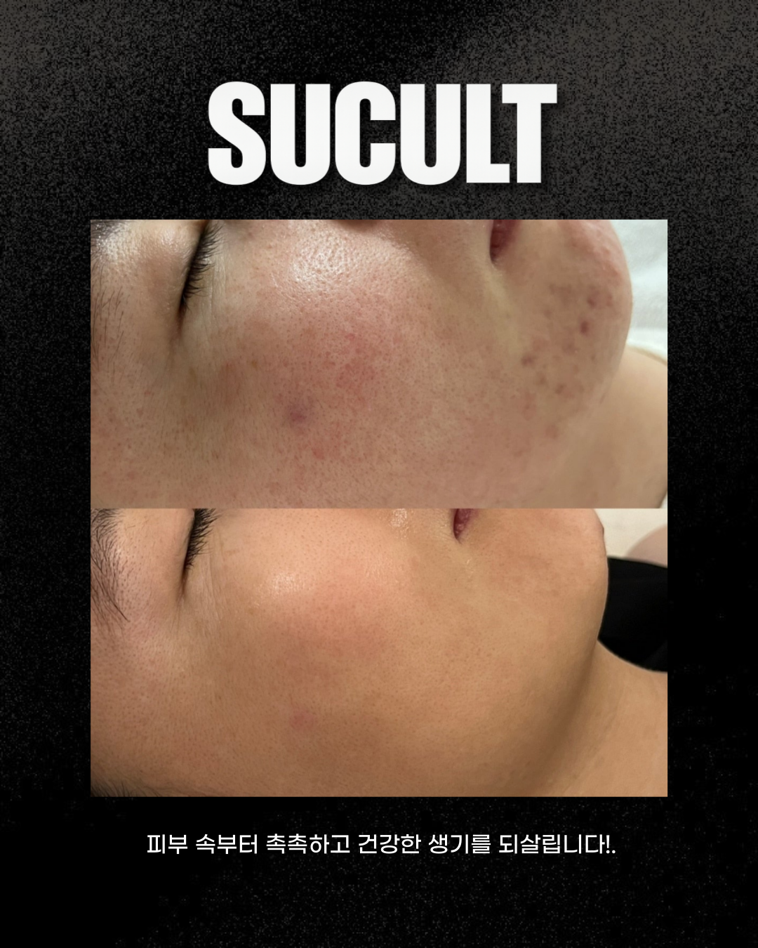 비움채 뷰티아비스 대표 이미지
