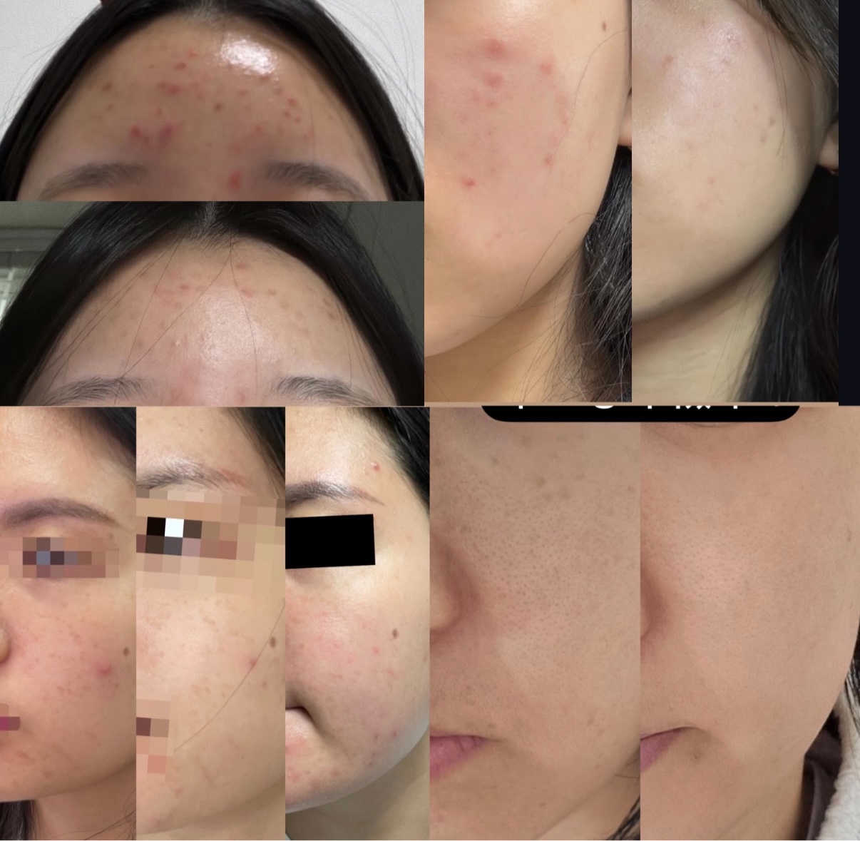 리뉴에 피부관리 대표 이미지