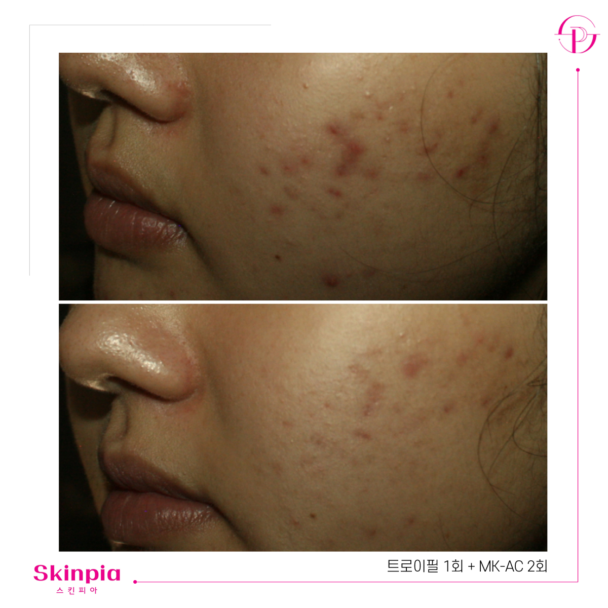 스킨피아 대표 이미지