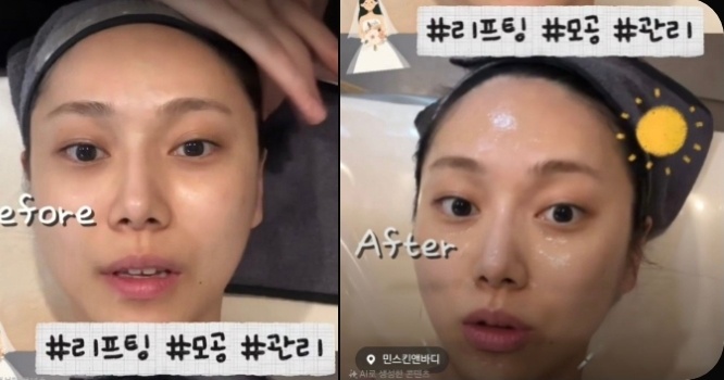 민스킨앤바디