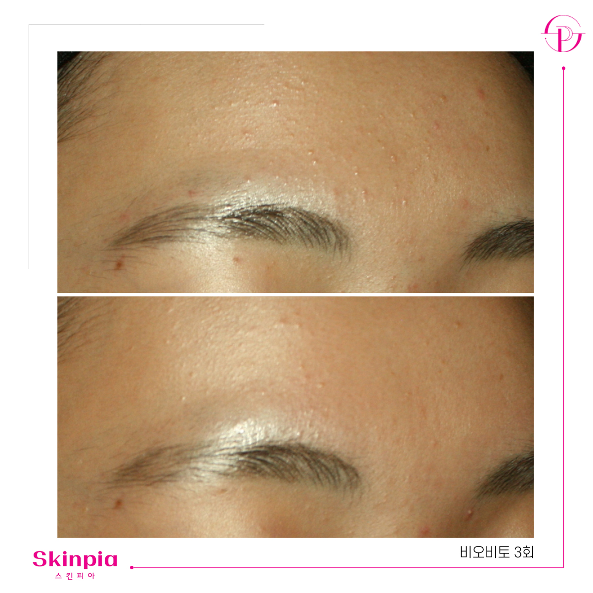 스킨피아 대표 이미지