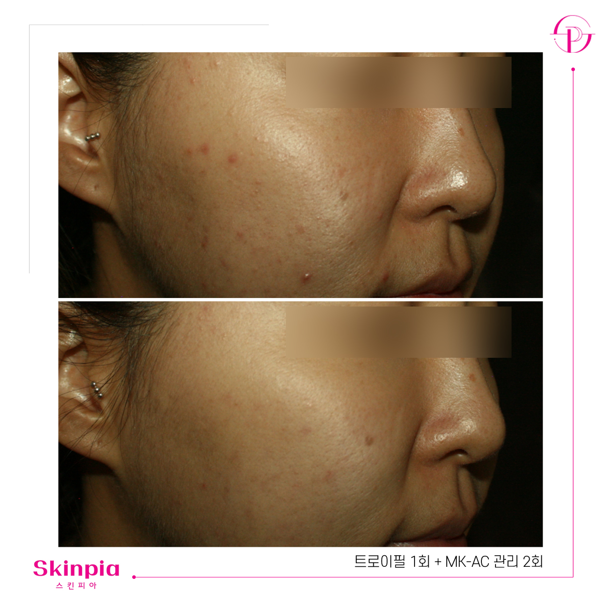 스킨피아 대표 이미지