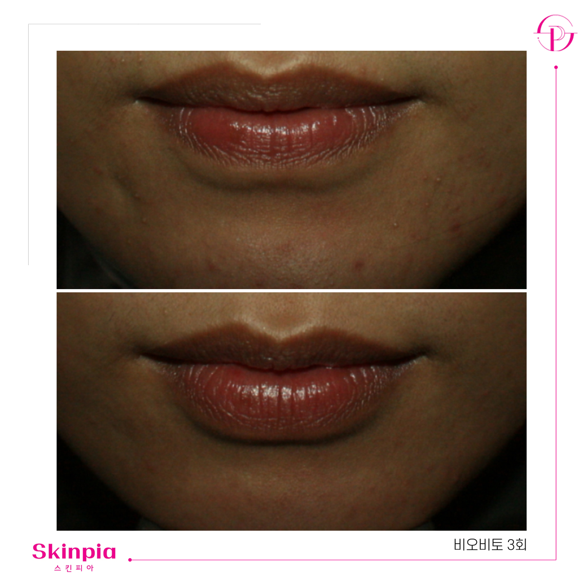 스킨피아 대표 이미지