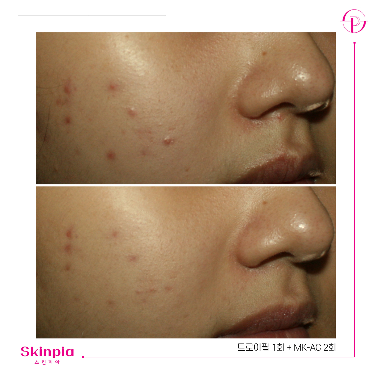 스킨피아 대표 이미지