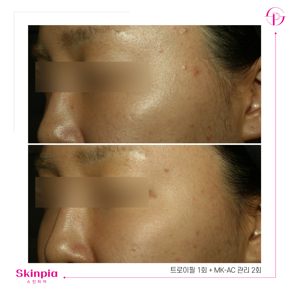 스킨피아 대표 이미지