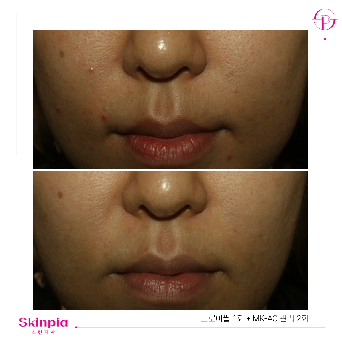 스킨피아 대표 이미지