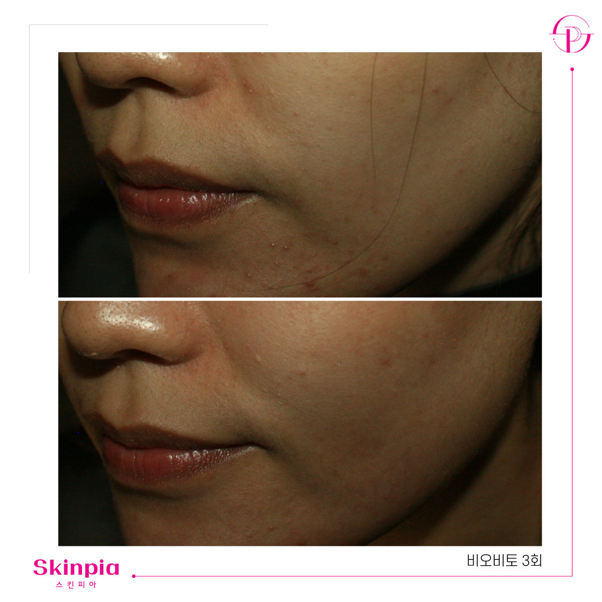 스킨피아 대표 이미지