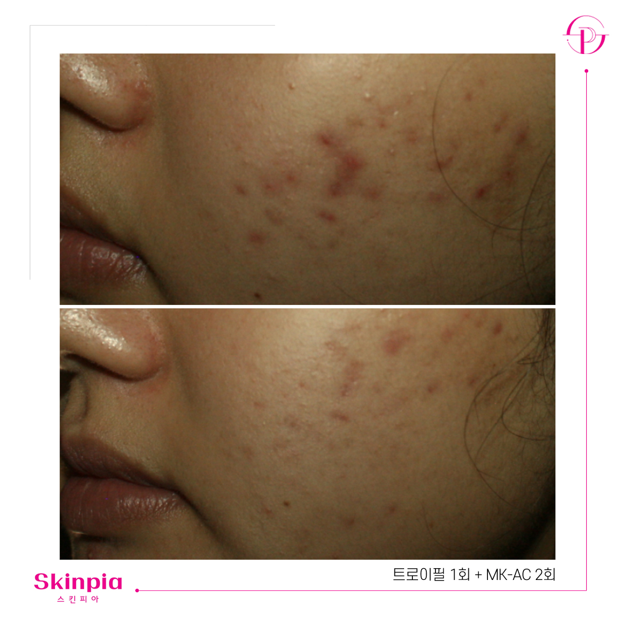 스킨피아 대표 이미지