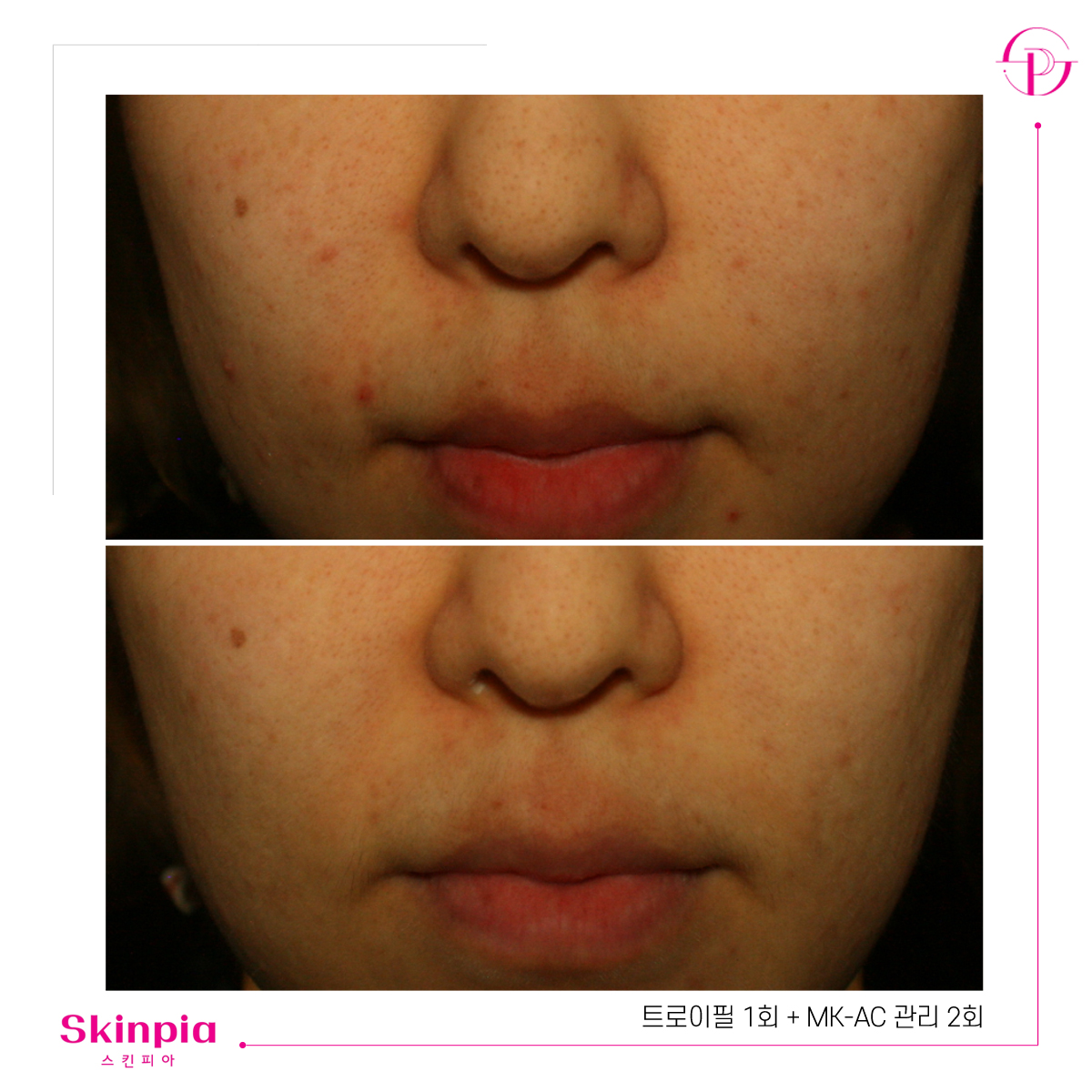 스킨피아 대표 이미지