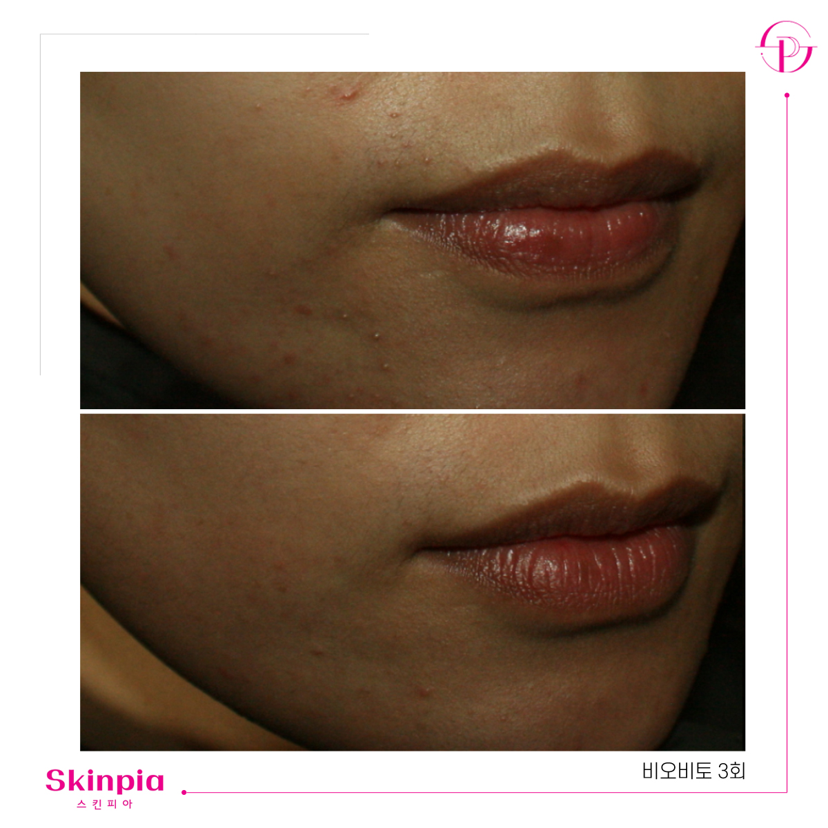 스킨피아 대표 이미지