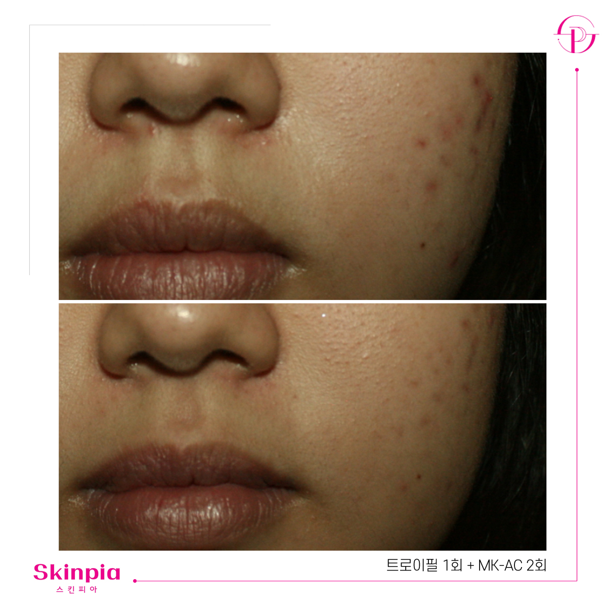 스킨피아 대표 이미지
