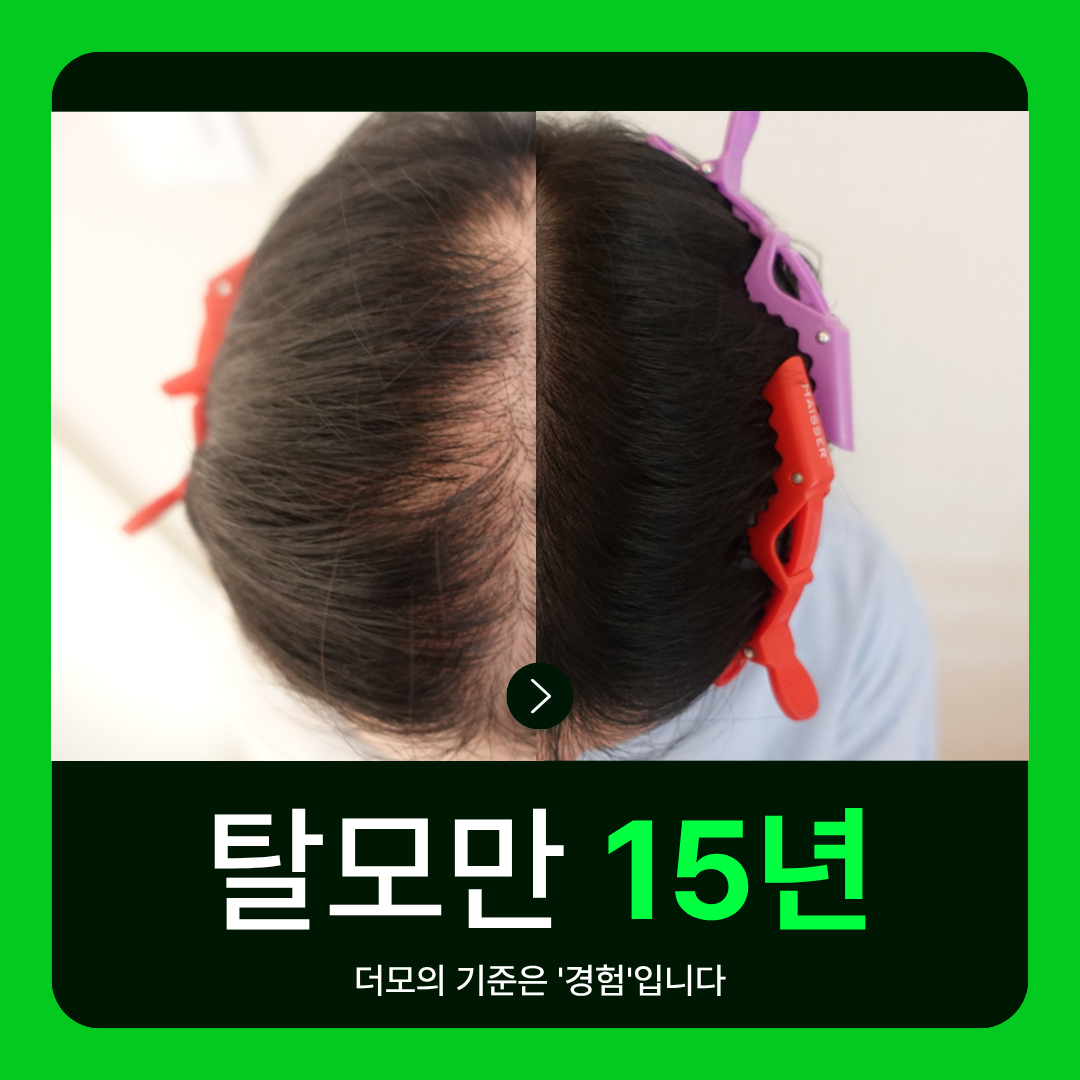 압구정더모의원 대표 이미지