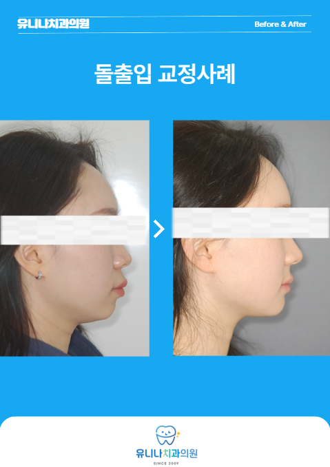 유니나치과의원 대표 이미지