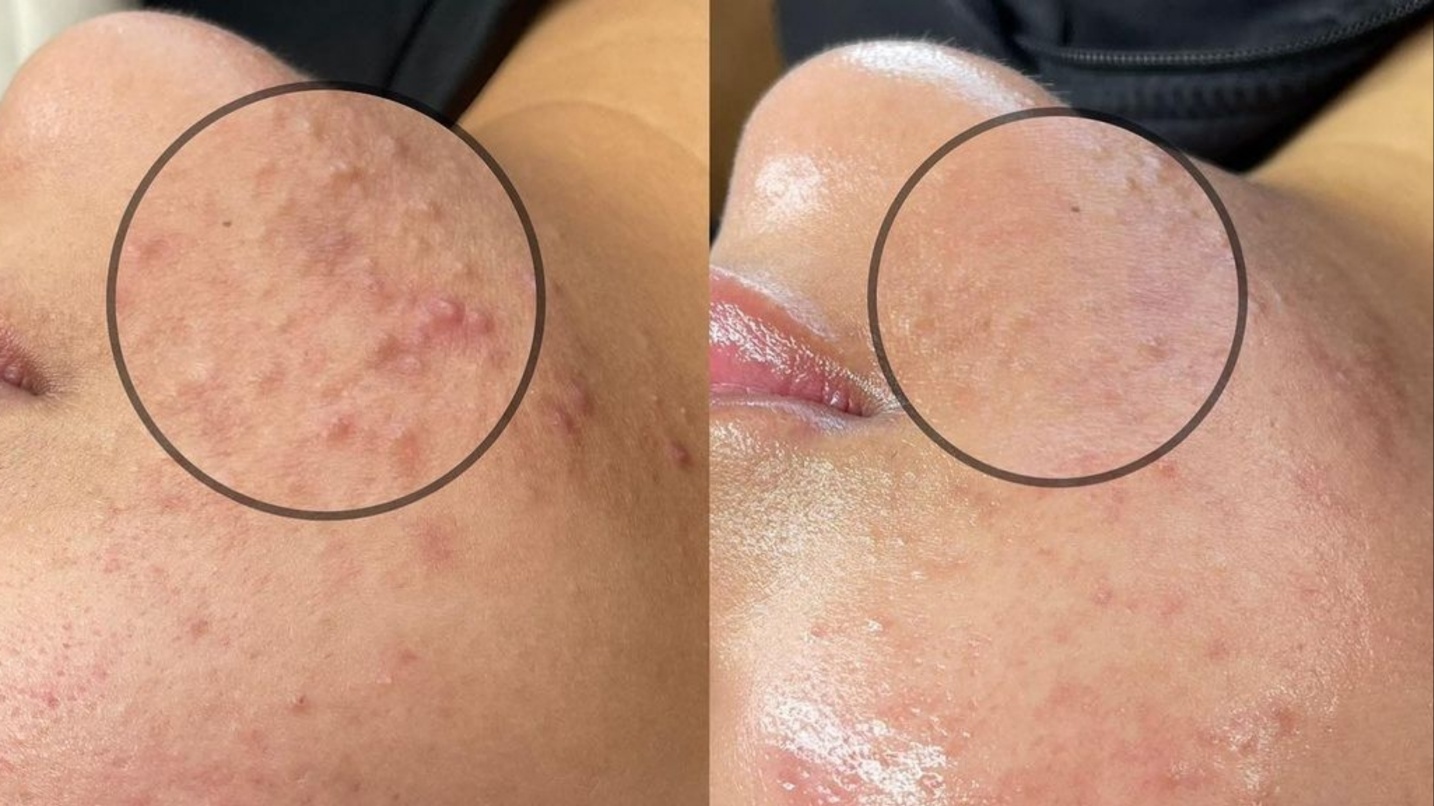 윤앤윤 에스테틱 원장님 진료