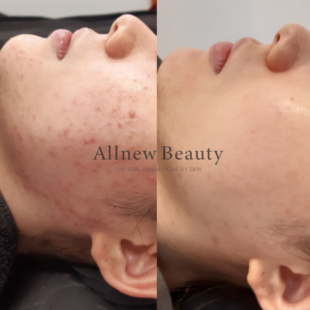 올뉴뷰티 분당점 대표 이미지