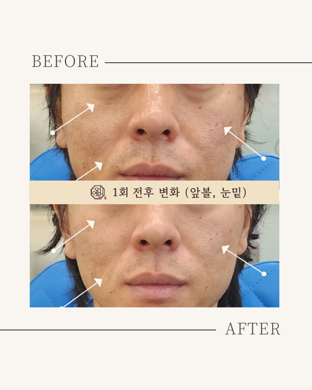 어예건 웰니스 페이스필라테스PT 바디컨디셔닝케어 광화문 대표 이미지