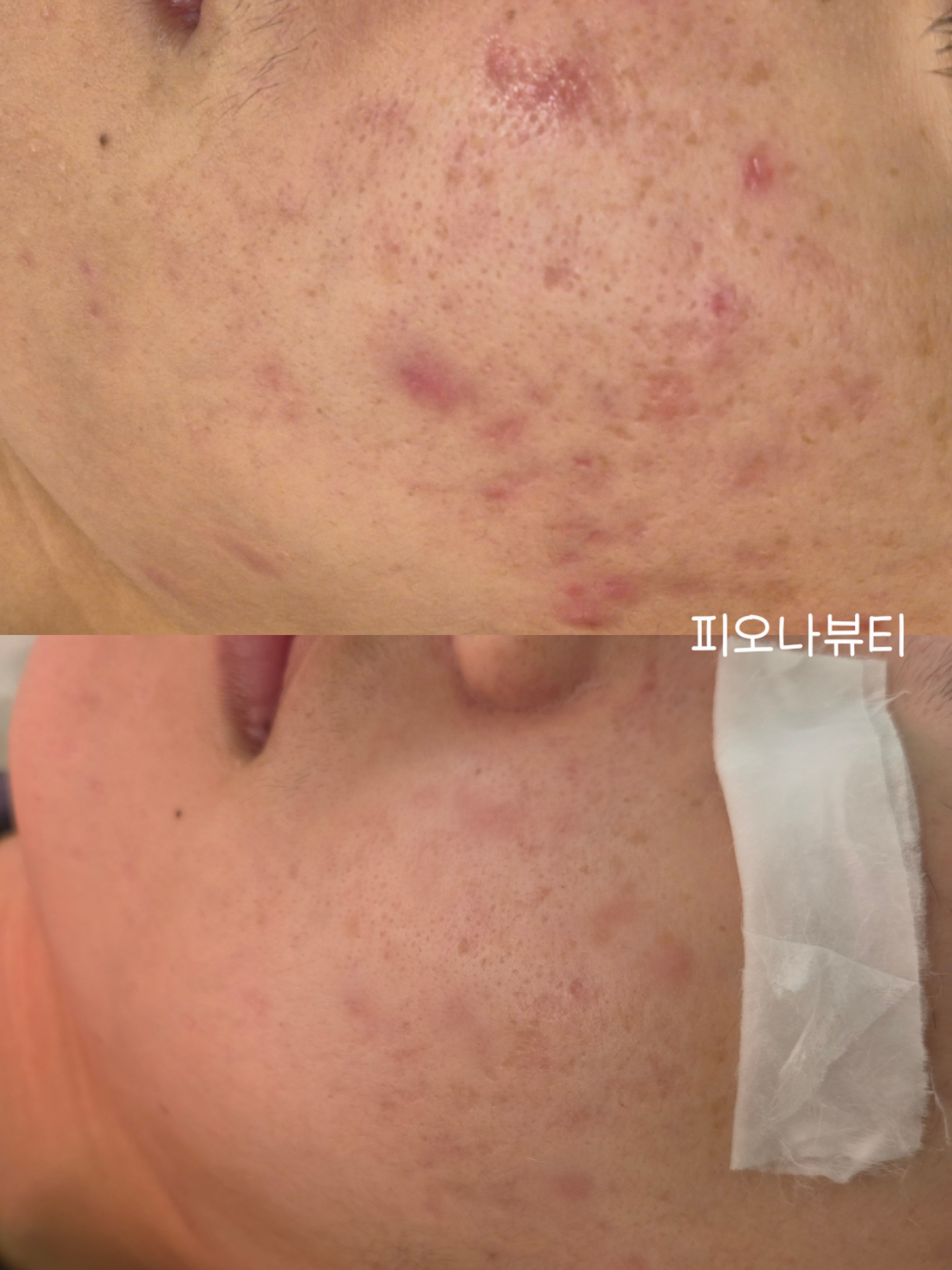 피오나뷰티랩 photo 4
