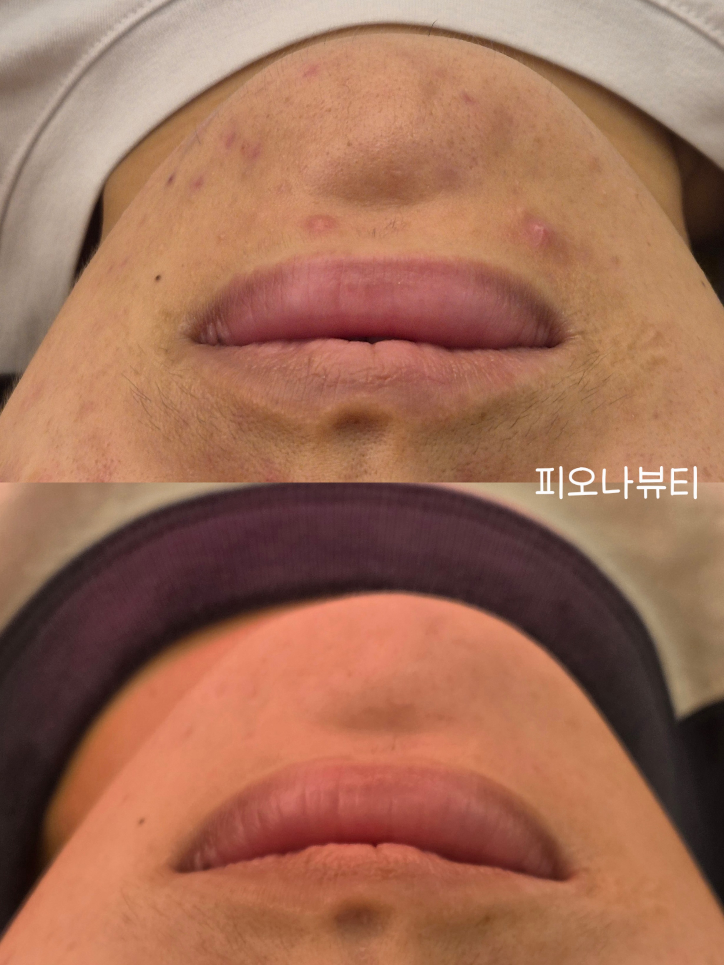 피오나뷰티랩 photo 3