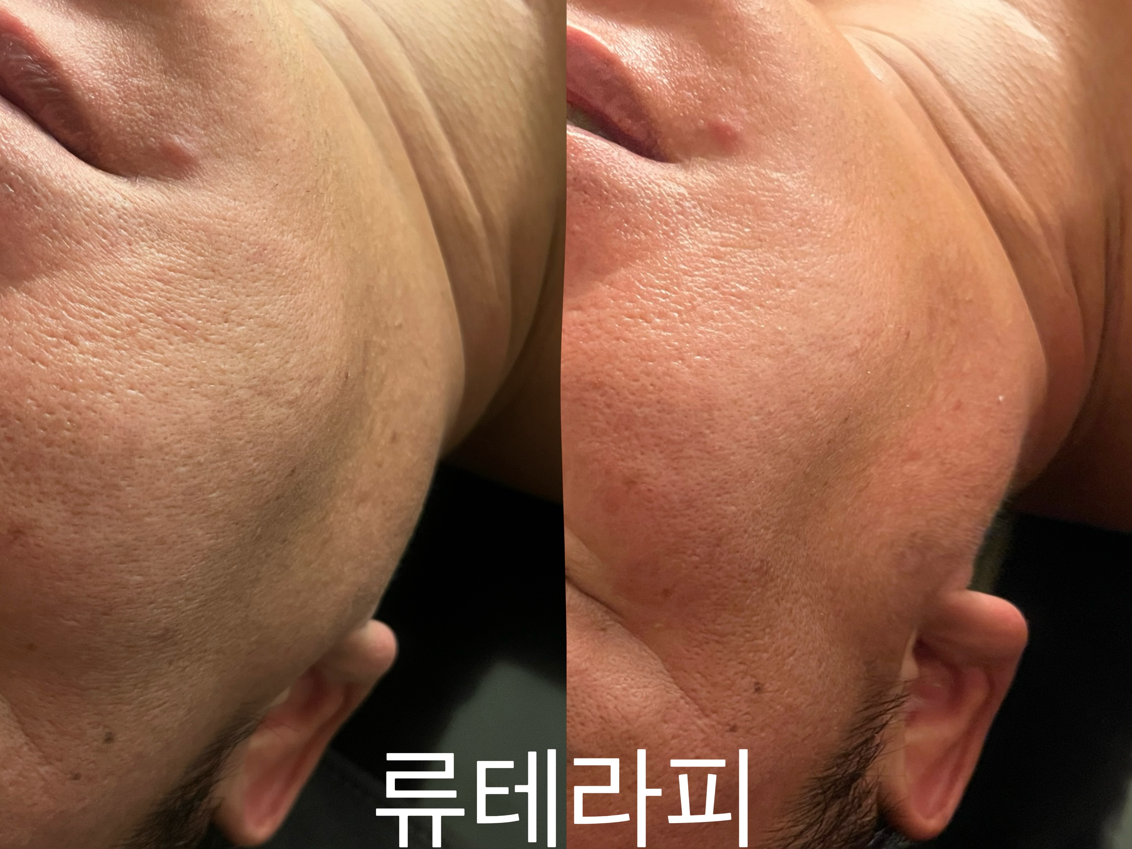 류테라피앤 마사지 연수점 photo 6