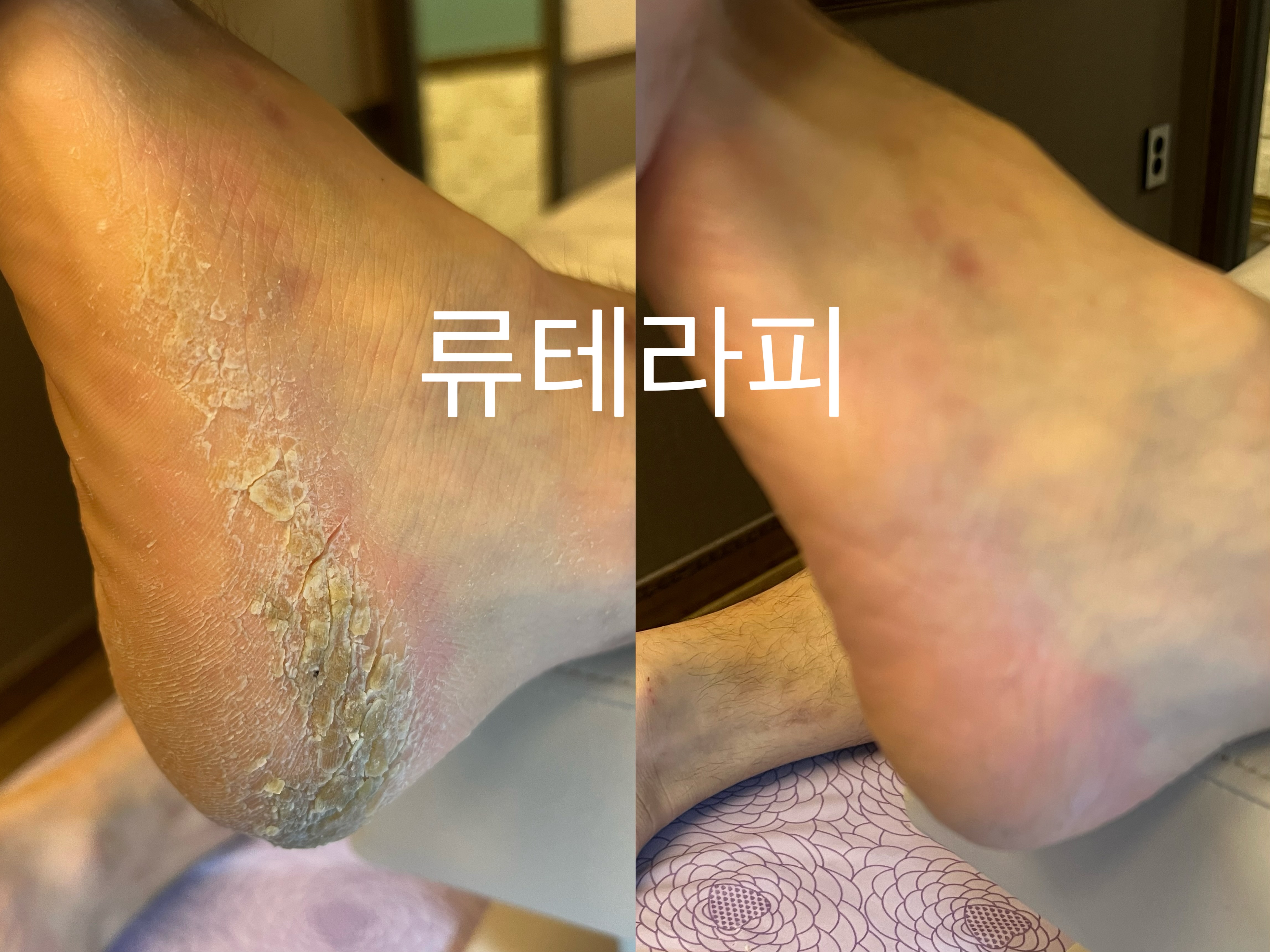 류테라피앤 마사지 연수점 photo 7