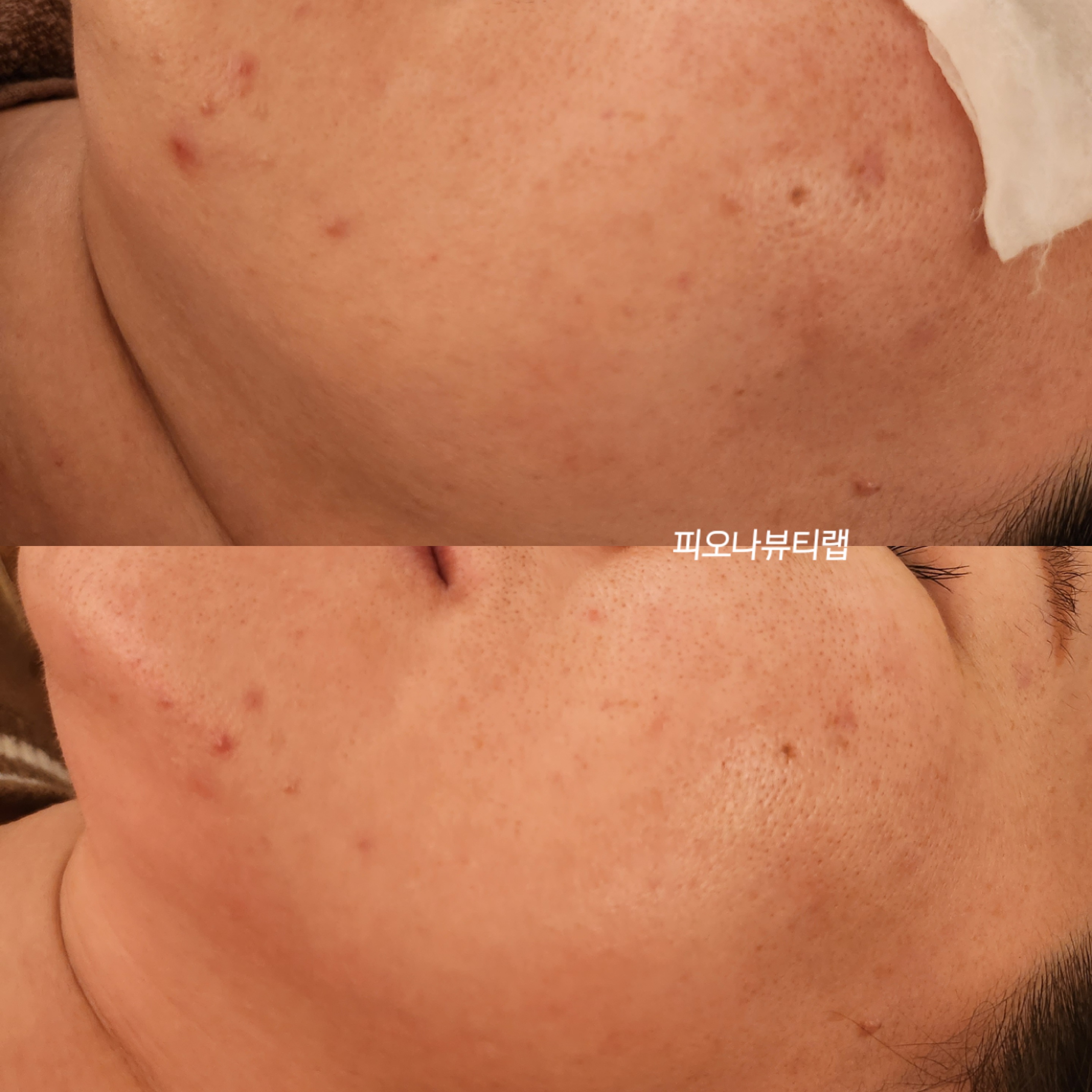 피오나뷰티랩 photo 7