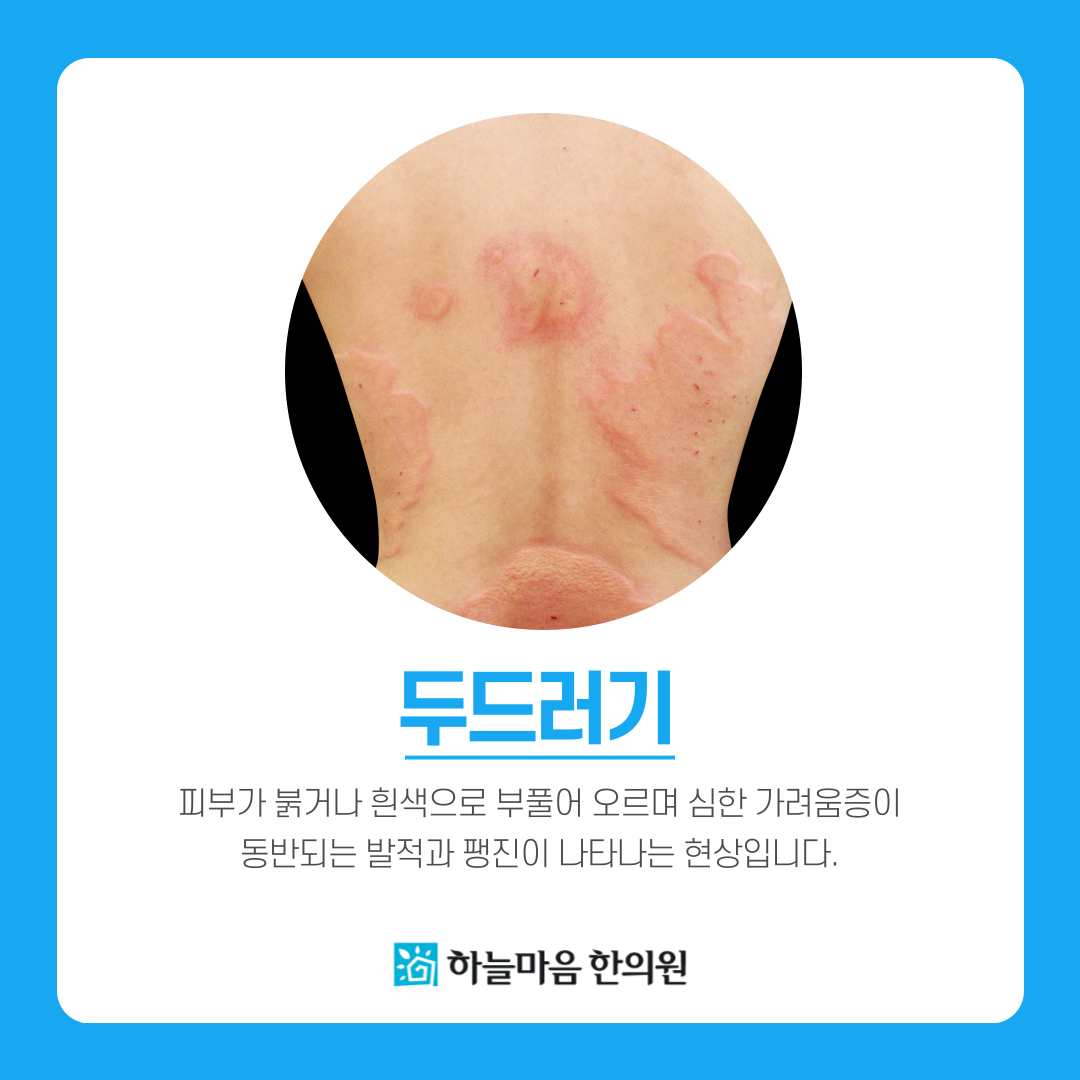 하늘마음한의원 을지로 대표 이미지