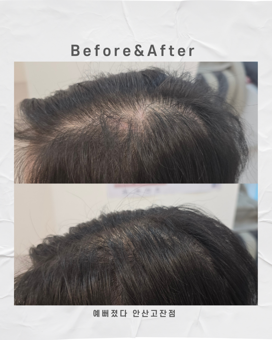 예뻐졌다 안산고잔점 대표 이미지